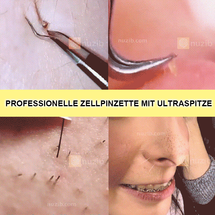 Hochpräzise Zellenklammern mit hoher Härte