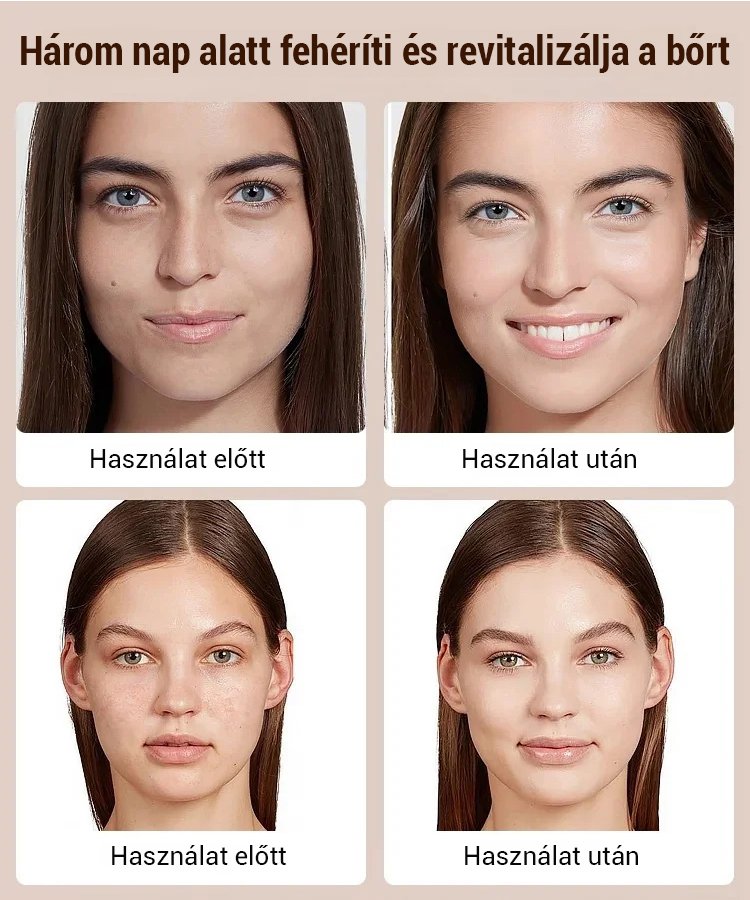 JUELREOU-【Minél többet mosod, annál fehérebb lesz】Fehérítő niacinamid arclemosó