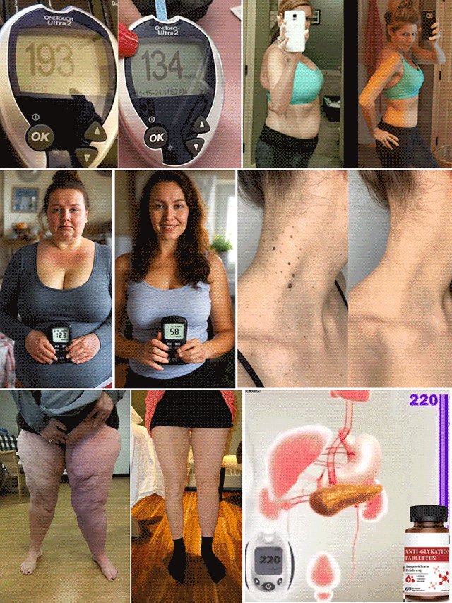 Blutzuckersenkende Tabletten