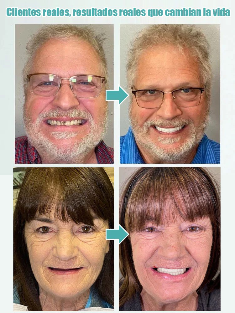 Prótesis dental completa con ajuste adaptable para una sonrisa segura