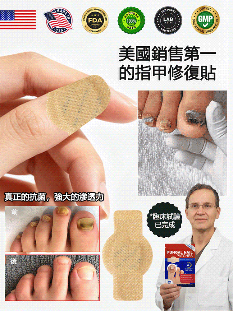 指甲修護矯正抑菌貼