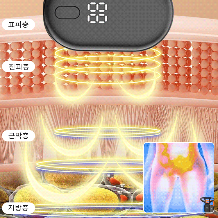 SL-[소염, 진통] 초음파 다이어트 기구
