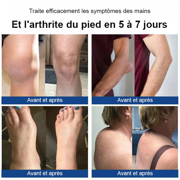 Crème réparatrice pour articulations au venin d'abeille