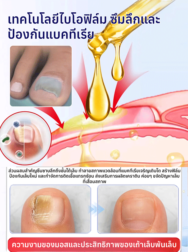 ✅ได้รับการรับรองจาก อย-น้ำยาบำรุงเล็บ