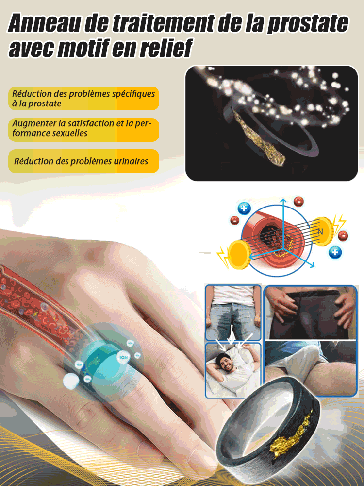 Anneau de traitement de la prostate à motif gaufré