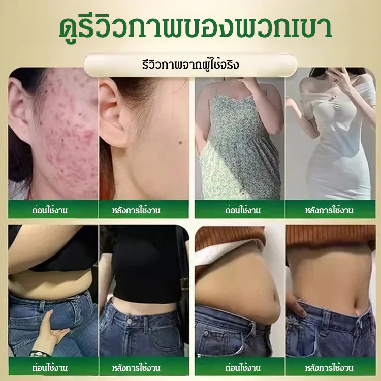 【สวยขึ้น ผอมลง】สาลี่หนามแห้ง ราชาแห่งวิตามินซี
