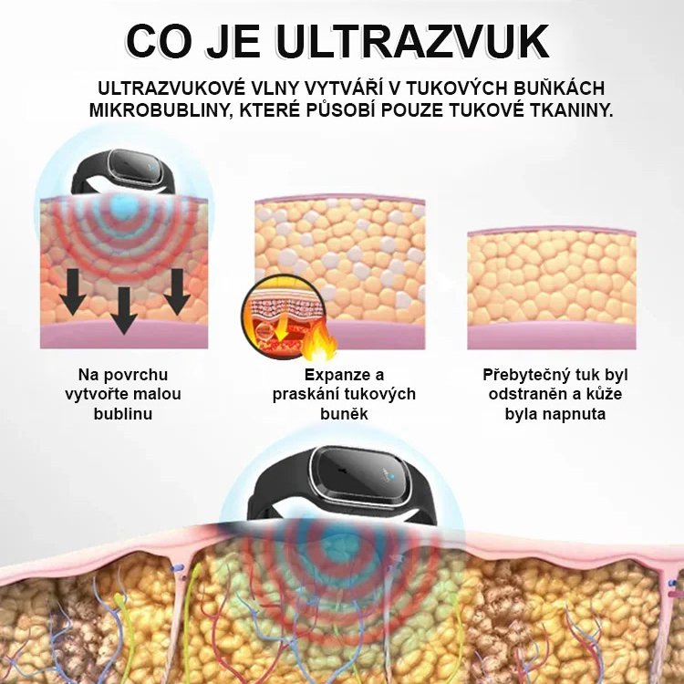 Ultrazvukový elektronický náramek na hubnutí