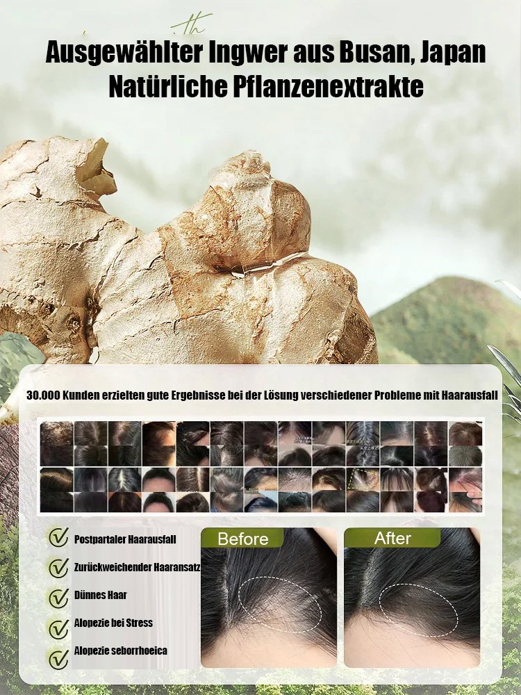 1 kaufen, 1 bekommen  Explosive Ginger Phytochemical Hair Loss Control Shampoo