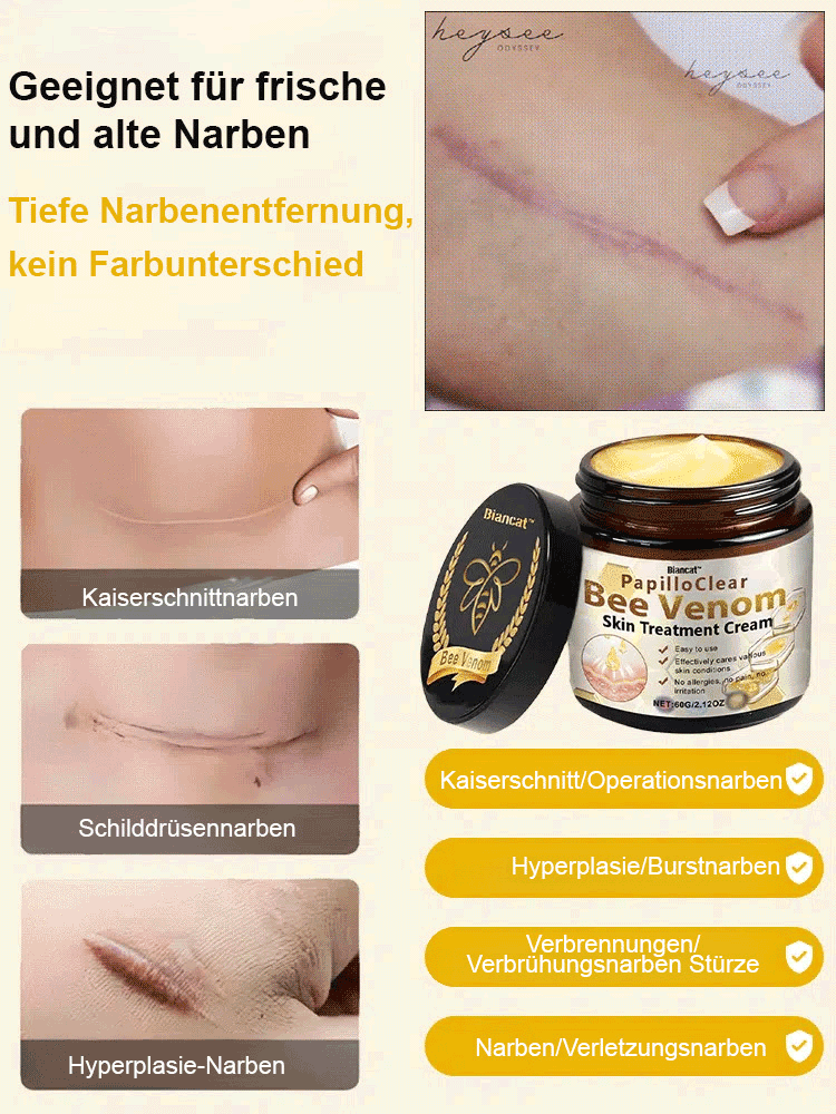 Bienengift Hautnarben glättende Creme