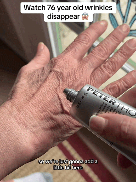 peterthomasr Eye Tightener