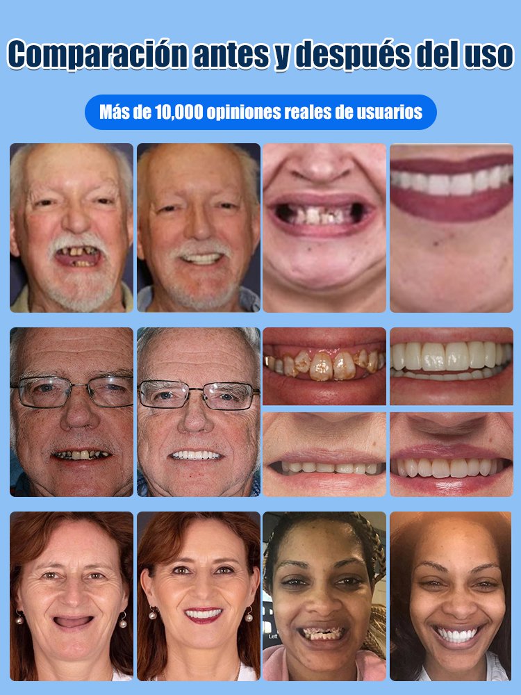 Kit de prótesis dentales completas con soporte óseo, aprobado por FDA