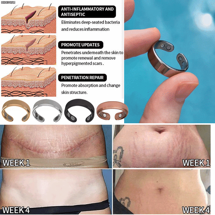 Magnetic Ring Health Ring