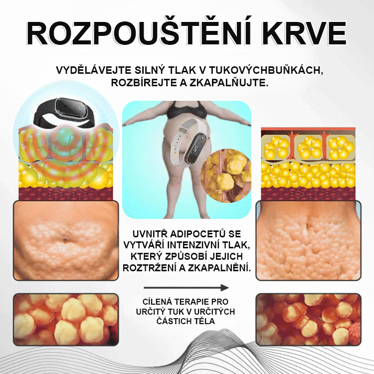 Ultrazvukový elektronický náramek na hubnutí