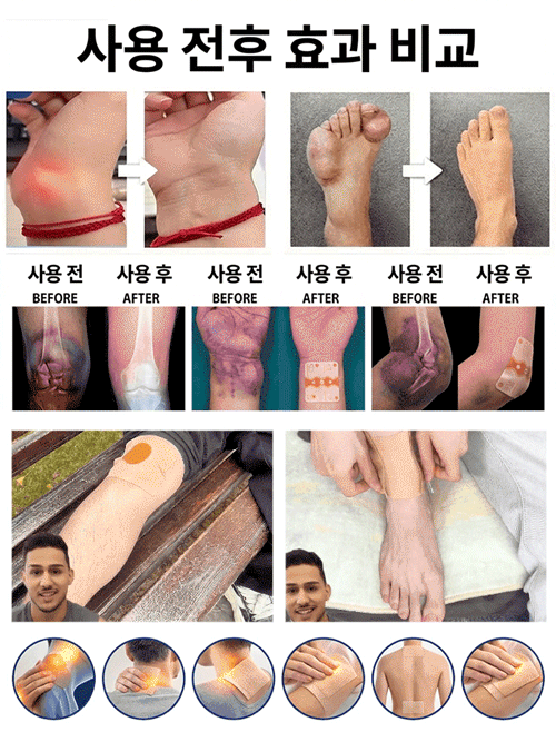 천연 허브 성분 통증 완화 패치