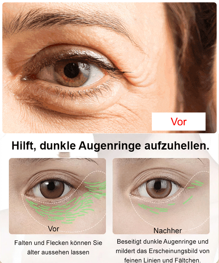 Sofortiges straffendes Augenserum