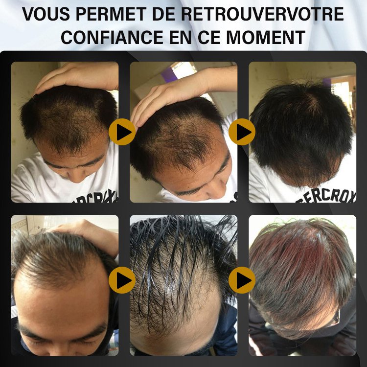 Spray de croissance FEG