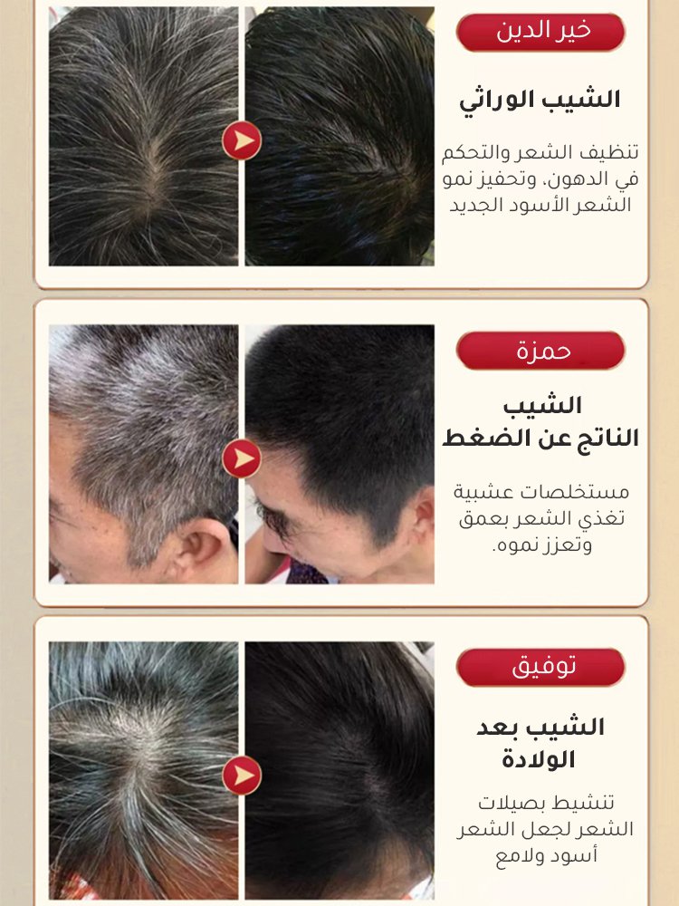 【قل وداعاً للشعر الأبيض】 صبغة شعر نباتية لطيفة لتغطية الشيب