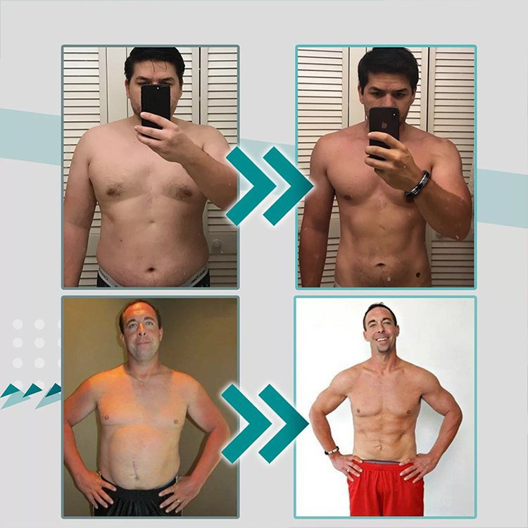 자기 요법 팔찌