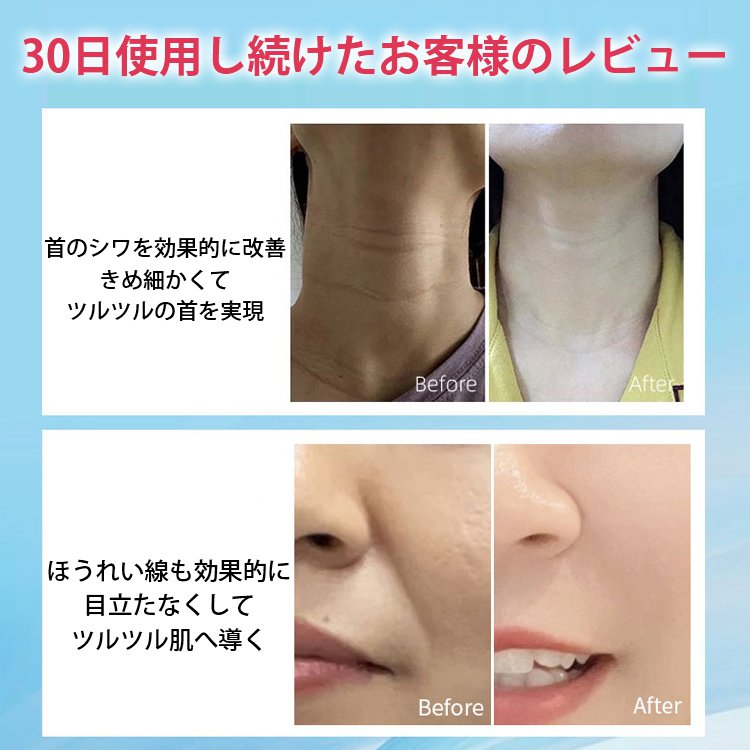 リフトアップシワ改善美顔器