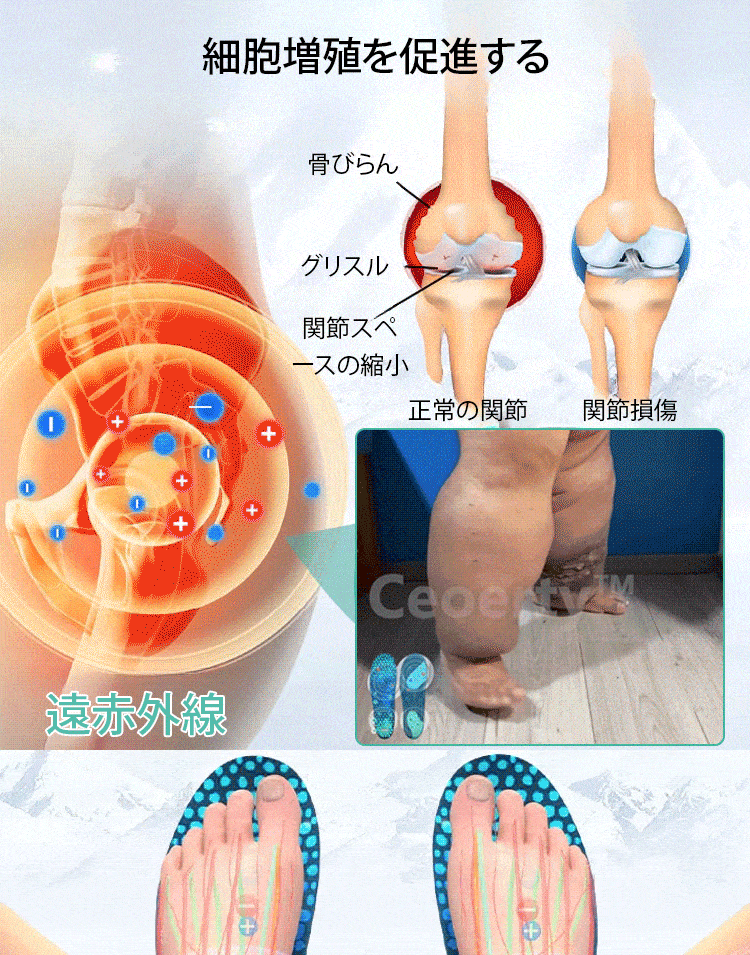 アイスシルク医療用インソール