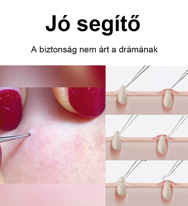 Nagy pontosságú és nagy keménységű cellabilincs