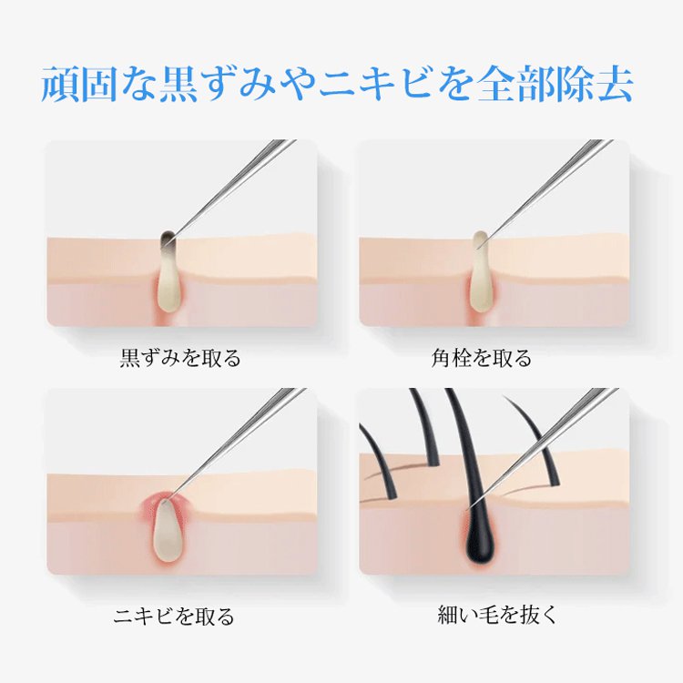 ステンレススチールコメドプッシャー