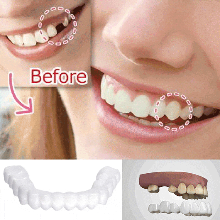 五代模擬美白牙套