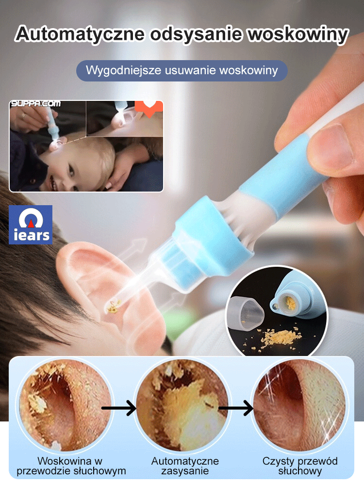 Elektryczny odciągacz woskowiny usznejOdciągacz woskowiny usznej