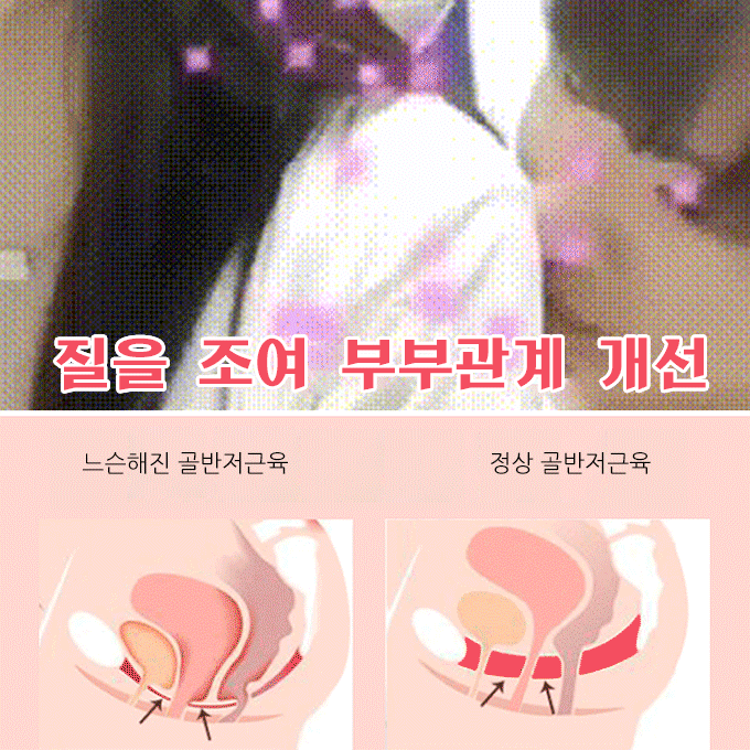 골반저근육 트레이닝 기구