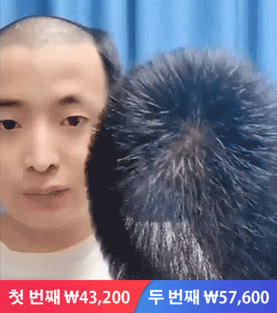 정수리 시뮬레이션 헴라인 가발